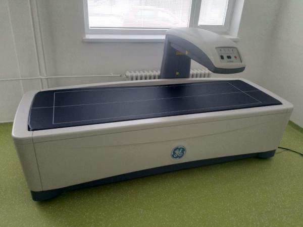 Osteoporóza osteodenzitometrie kosti Praha