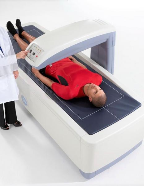 Osteoporóza osteodenzitometrie kosti Praha