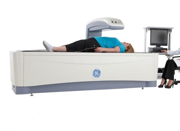 Osteoporóza osteodenzitometrie kosti Praha